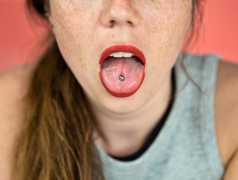 Modas Que Estropean Los Dientes