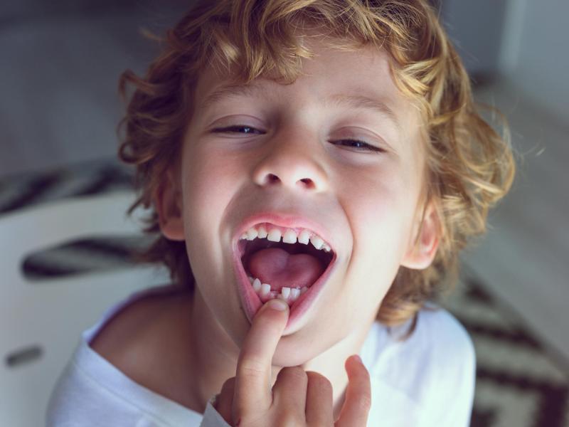 Vale La Pena Restaurar Los Dientes De Leche Si Igualmente Se Van A Caer