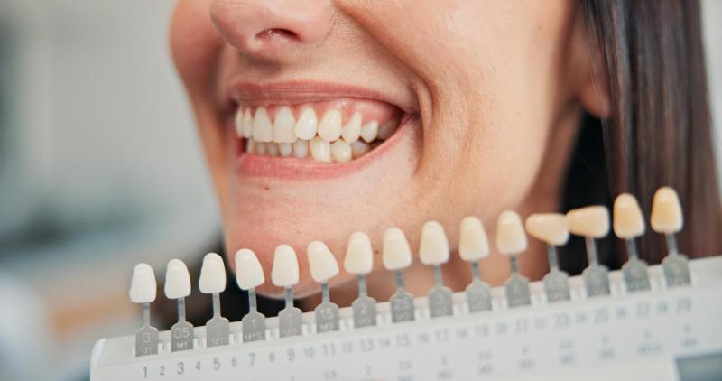 Qué Factores Influyen En El Color De Los Dientes