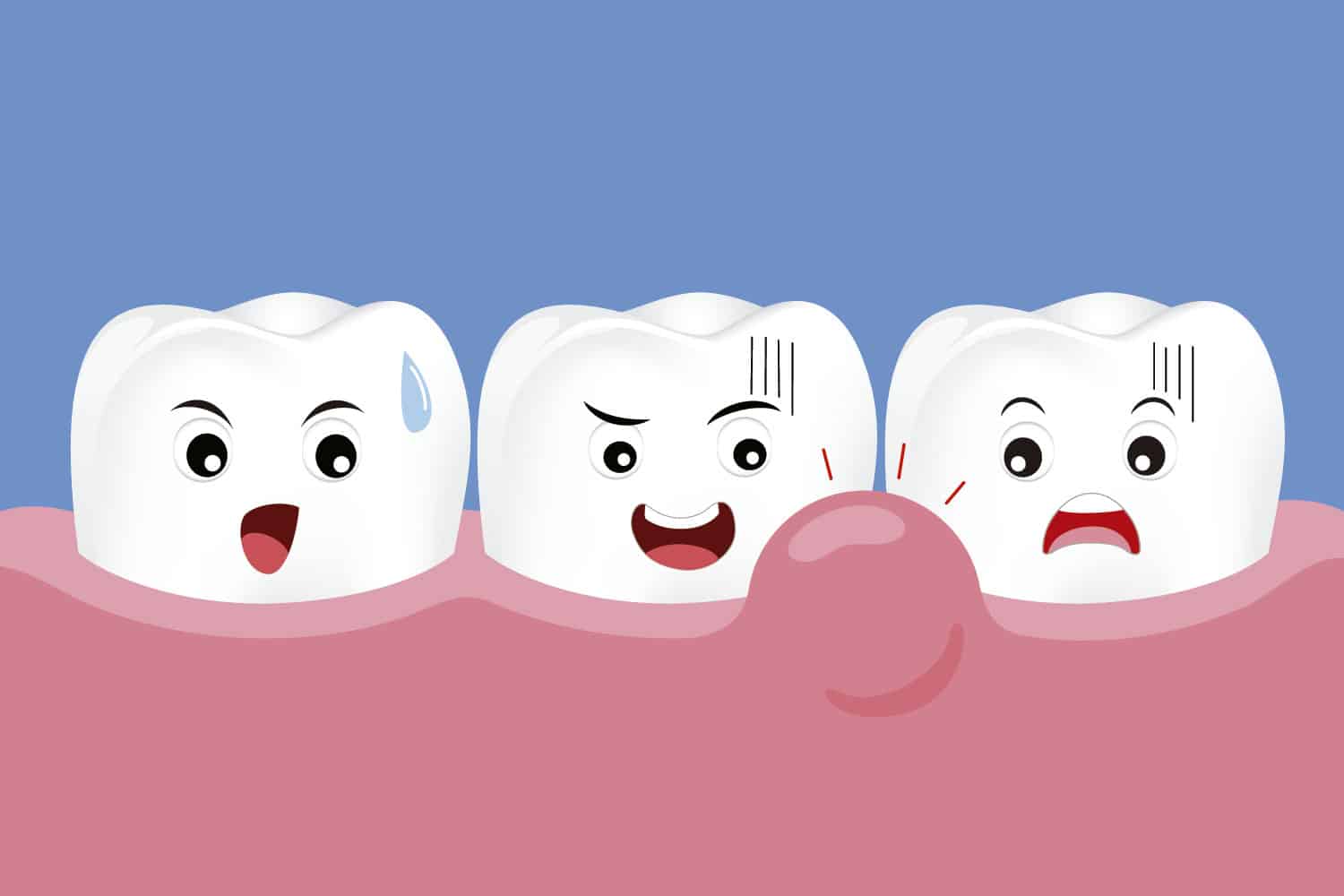 Alerta Encias Descubre Que Es La Enfermedad Periodontal Y Como Prevenirla
