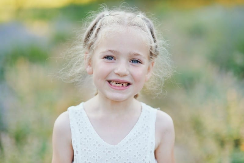 ¿Porqué Se Caen Los Dientes De Leche?