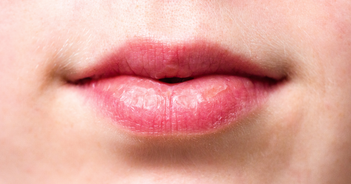 Mouth 2160205 1