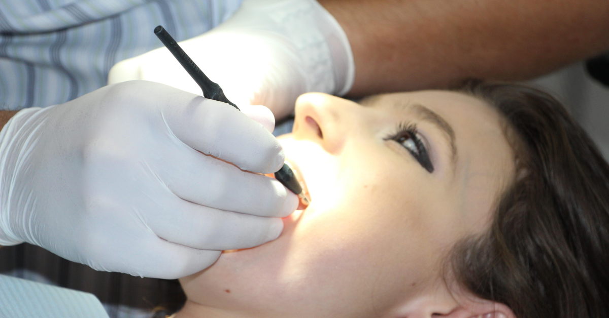 Teeth Cleaning 1514692 1